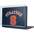 Syracuse University S Blue MacBook Cases